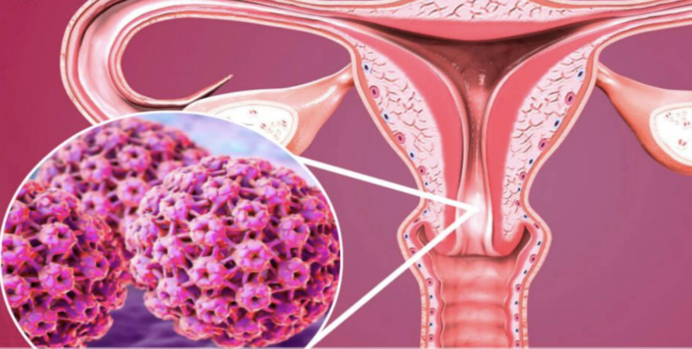 Dra. Marcella Conz Coloproctologia, Laser em coloproctologia
▫️Doenças Inflamatórias Intestinais  São Bernardo do Campo